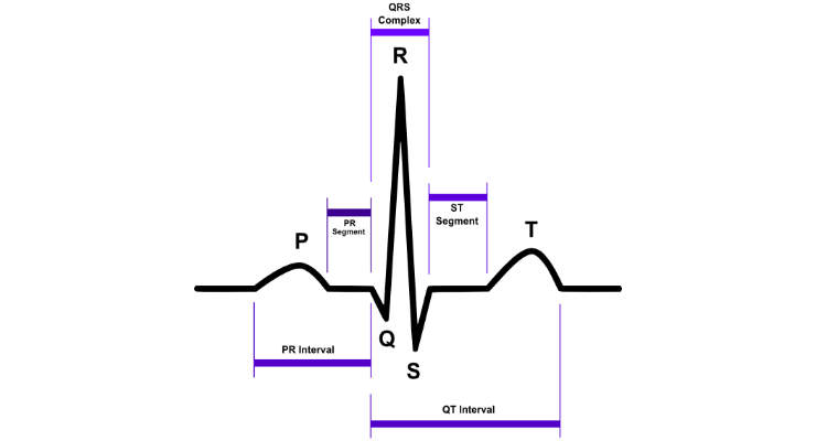 ECG basics