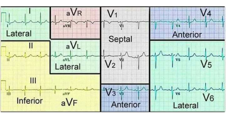 ECG parts localization
